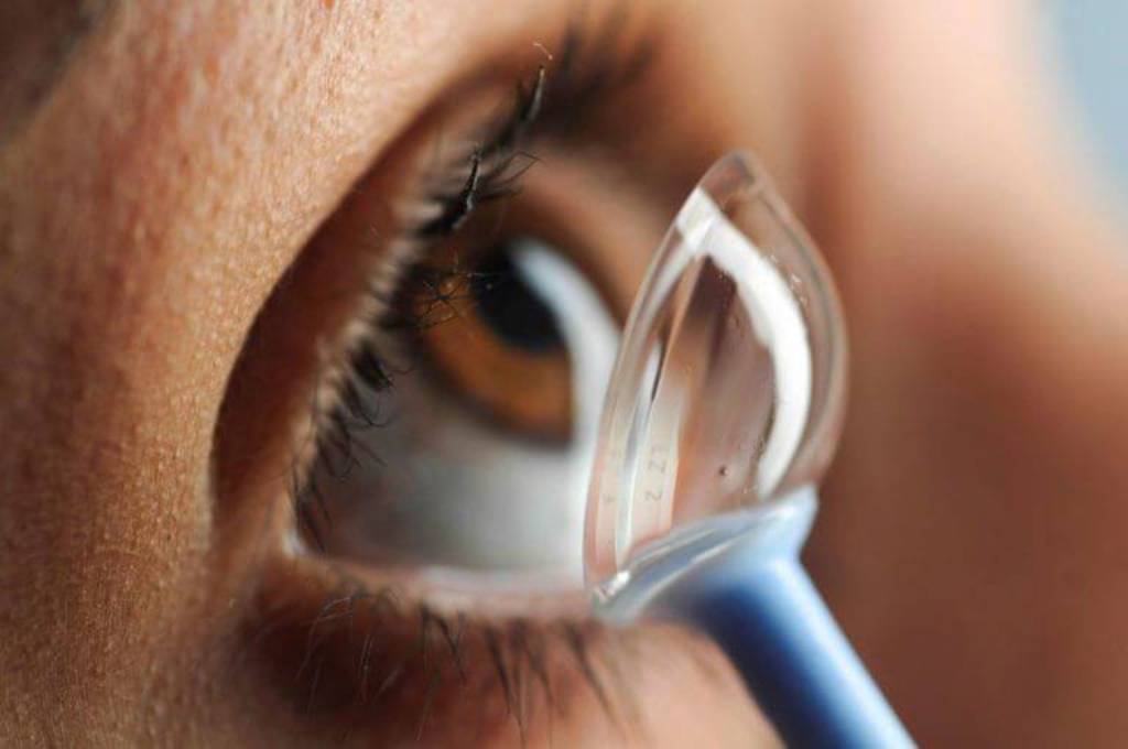 Optometrist Contact Lens Fitting